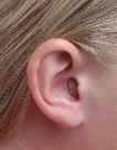 Image of a person wearing a completely in canal hearing aid