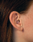 image of a person wearing an open fitting behind the ear hearing aid