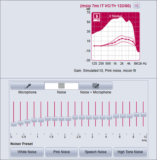 Image showing an extract from Siemens Connexx fitting software